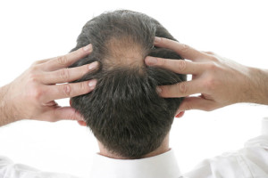 Calcitie-Massage du cuir chevelu