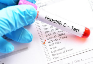 hepatitis-virica