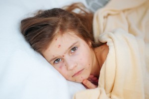 Closeup of cute sad little girl in bed. Varicella virus or Chick