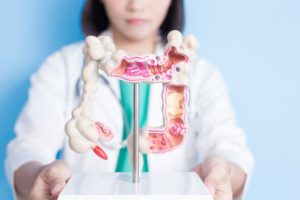 Síndrome del Intestino Irritable